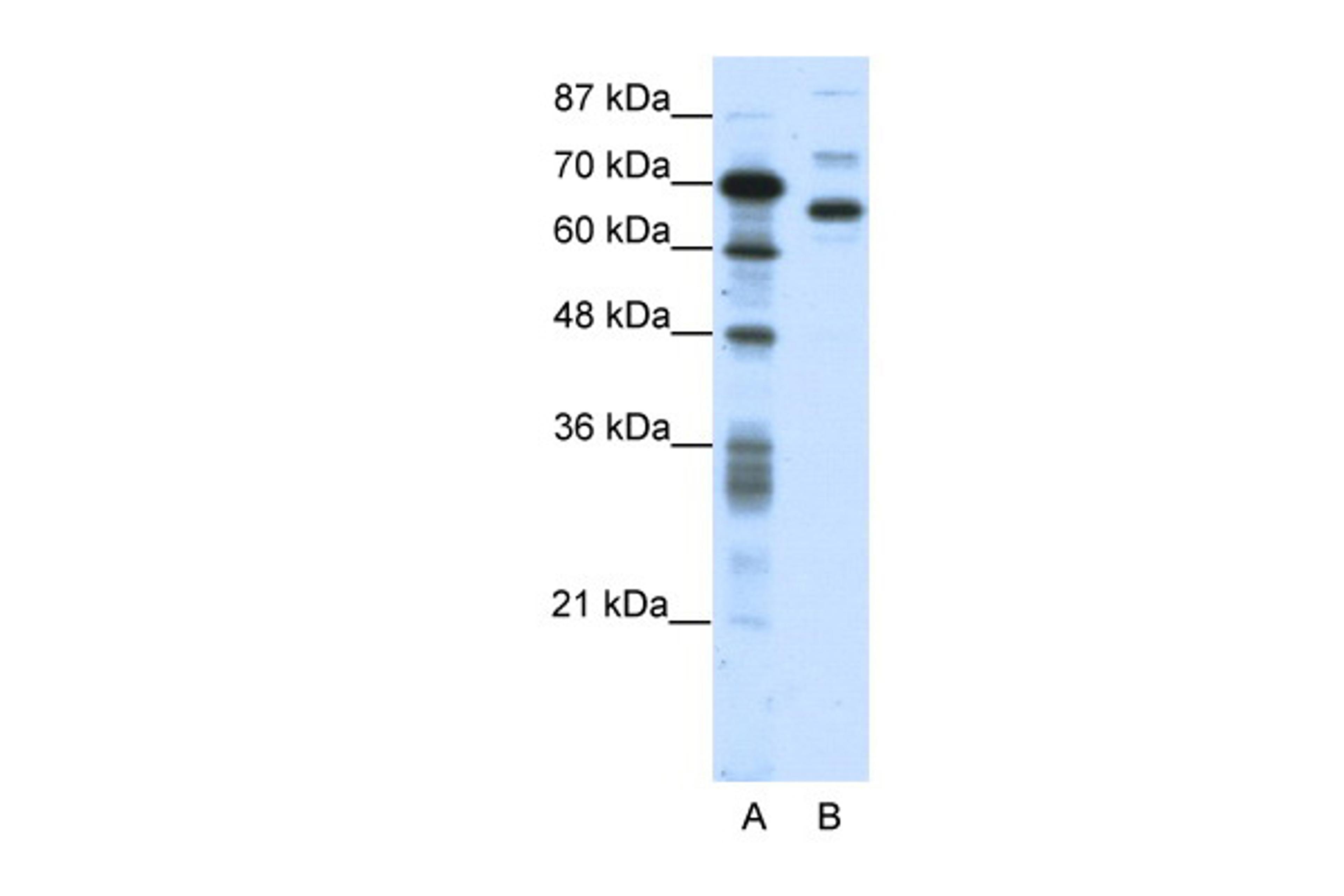 Antibody used in WB on Human Jurkat 0.2-1 ug/ml.