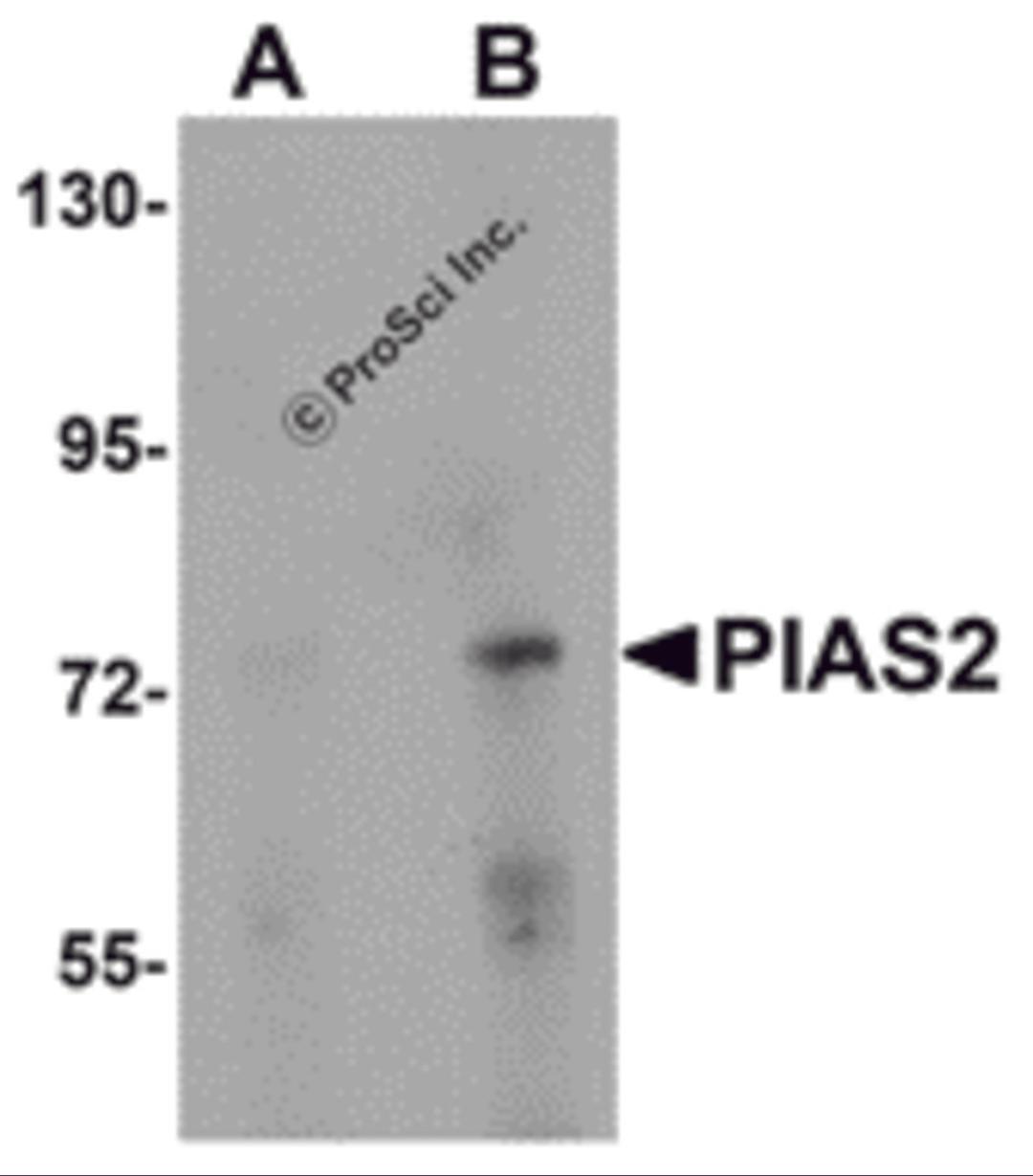 Western blot analysis of PIAS2 in rat brain tissue lysate with PIAS2 antibody at (A) 1 and (B) 2 &#956;g/mL.