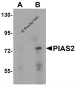 Western blot analysis of PIAS2 in rat brain tissue lysate with PIAS2 antibody at (A) 1 and (B) 2 &#956;g/mL.