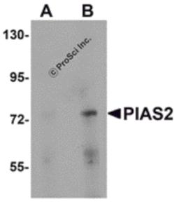 Western blot analysis of PIAS2 in rat brain tissue lysate with PIAS2 antibody at (A) 1 and (B) 2 μg/mL.