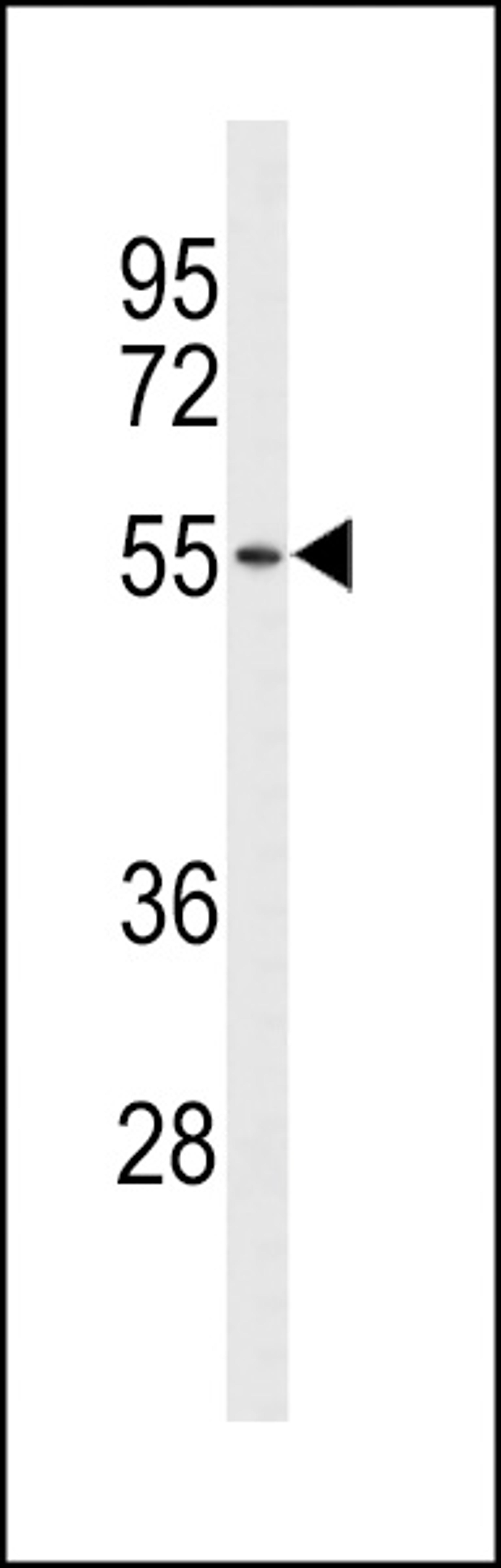 Western blot analysis of ACCN1 Antibody in NCI-H460 cell line lysates (35ug/lane)