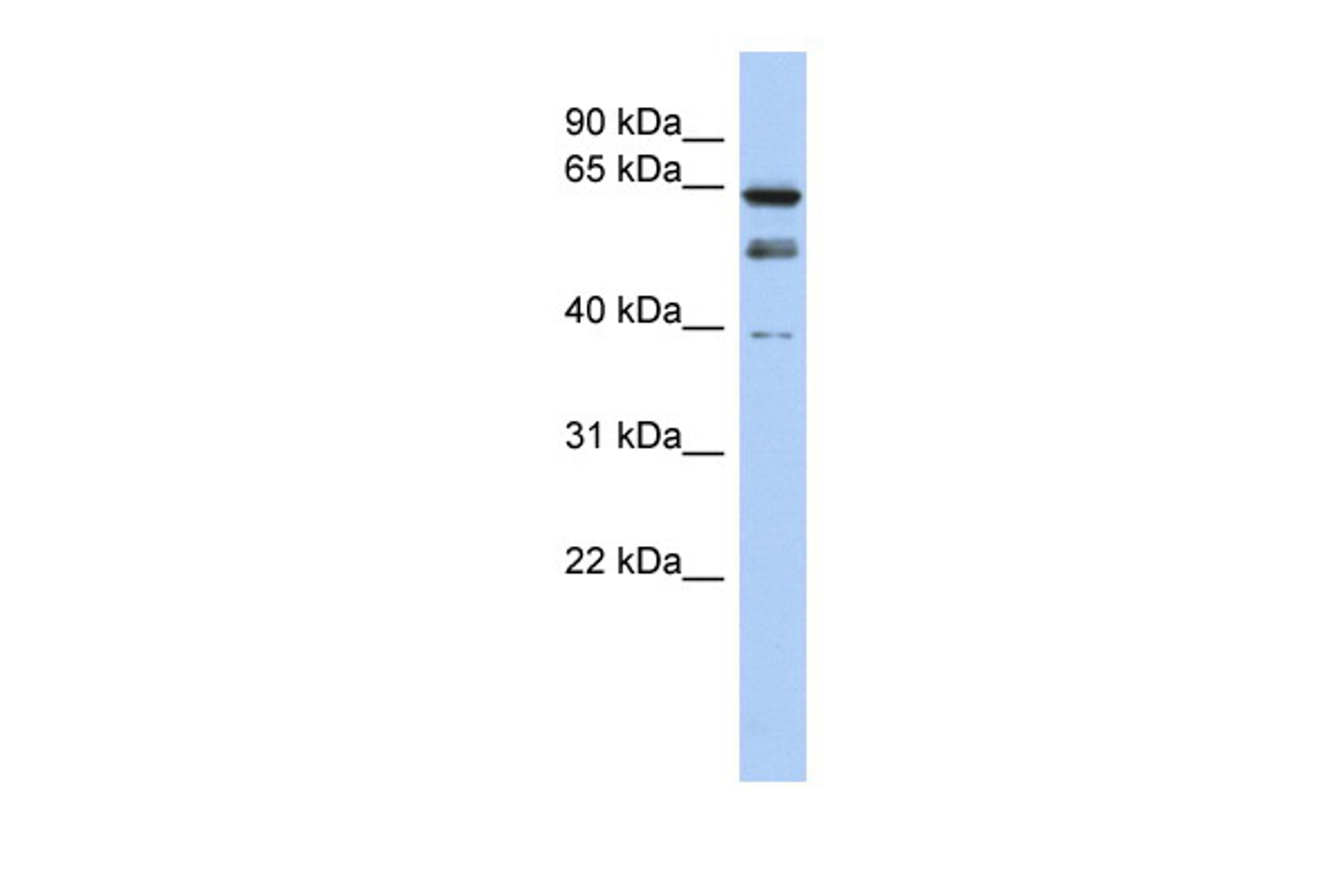 Antibody used in WB on Human OVCAR-3 at 0.2-1 ug/ml.