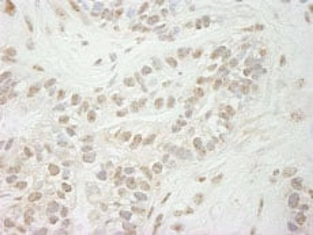 Detection of human JARID1B by immunohistochemistry.