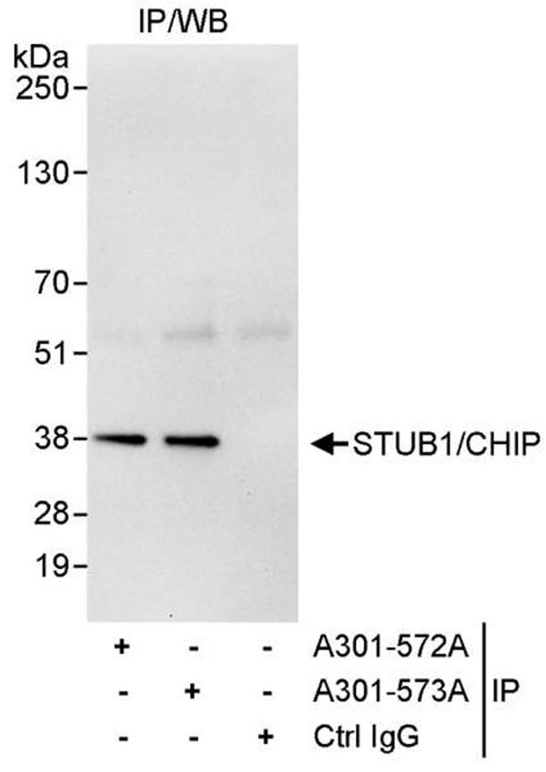 Detection of human STUB1/CHIP by WB of IP.