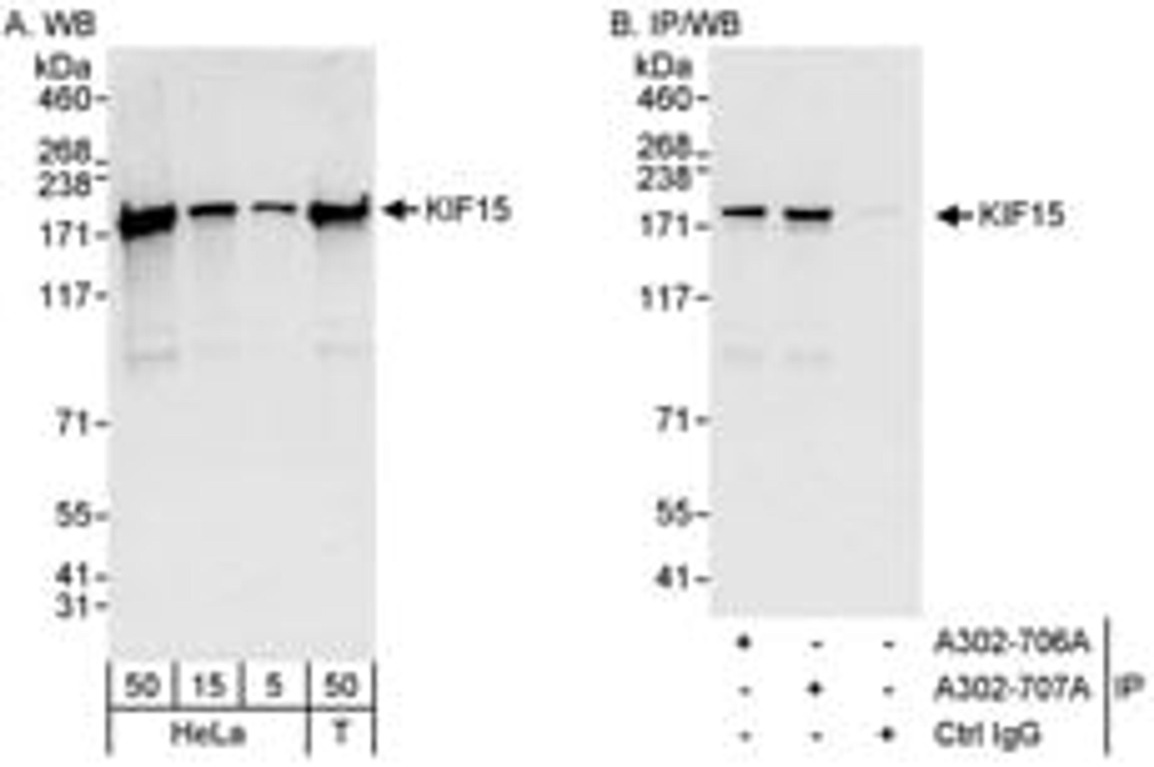 Detection of human KIF15 by western blot and immunoprecipitation.