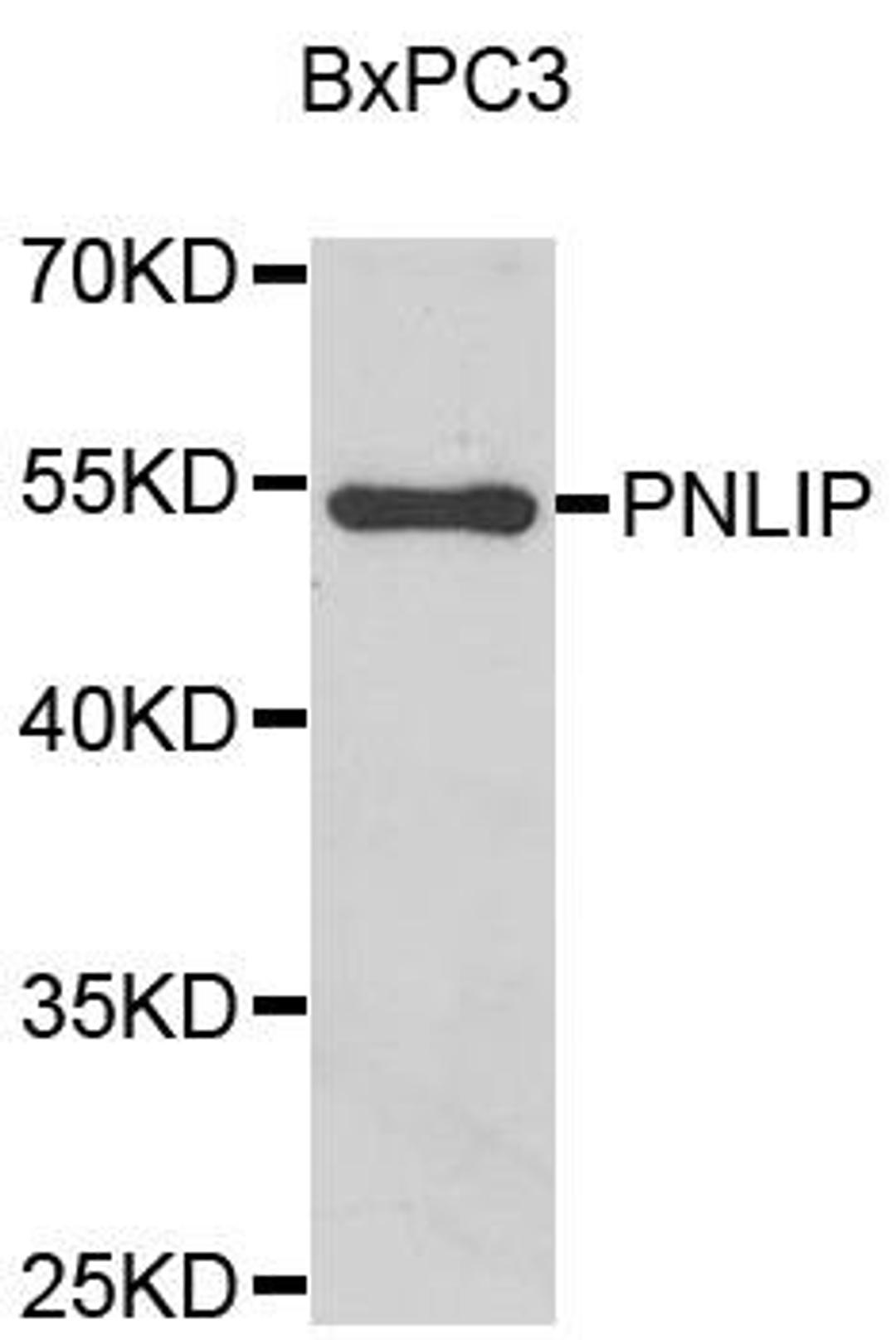 Western blot analysis of BxPC3 cell lysate using PNLIP antibody