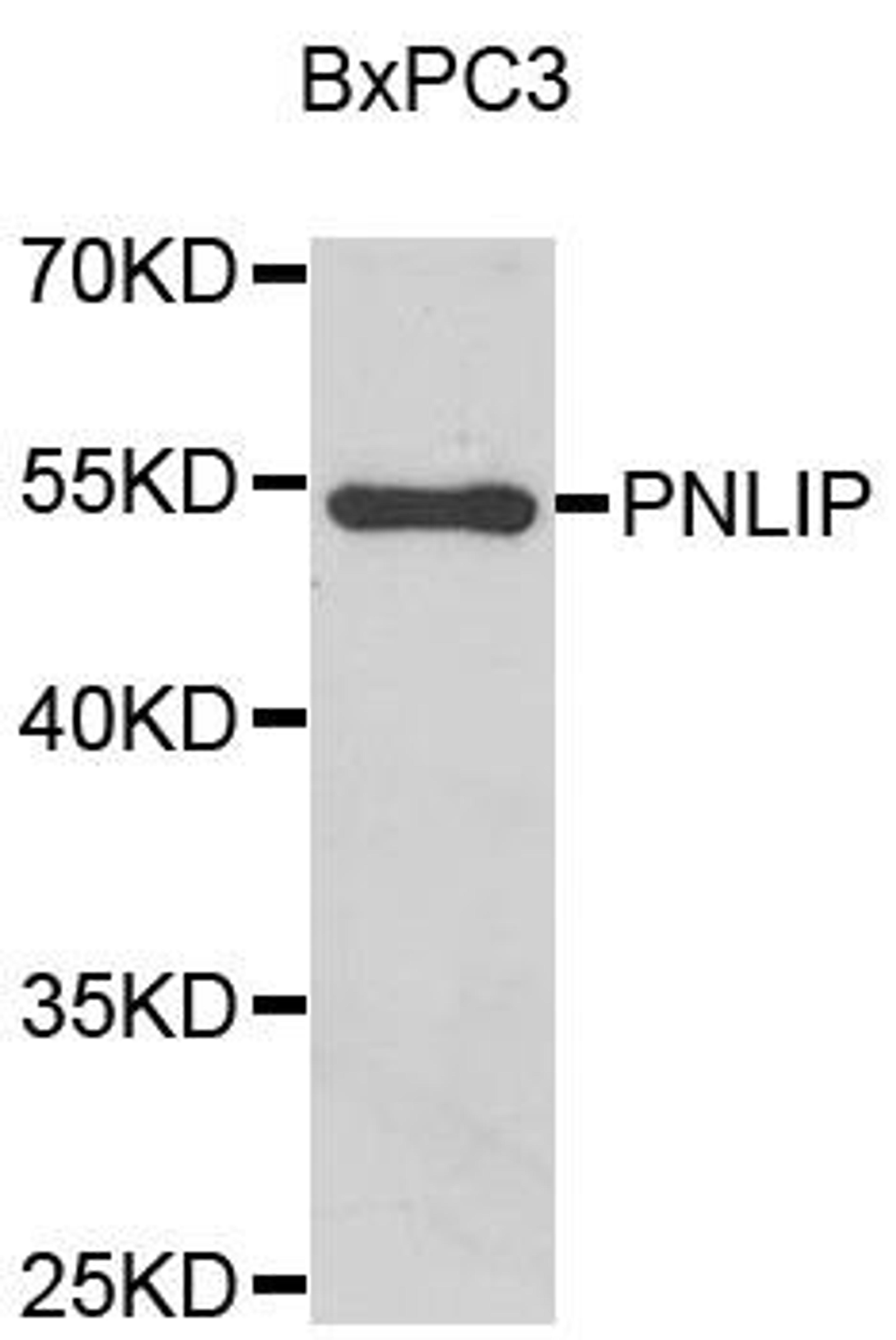 Western blot analysis of BxPC3 cell lysate using PNLIP antibody