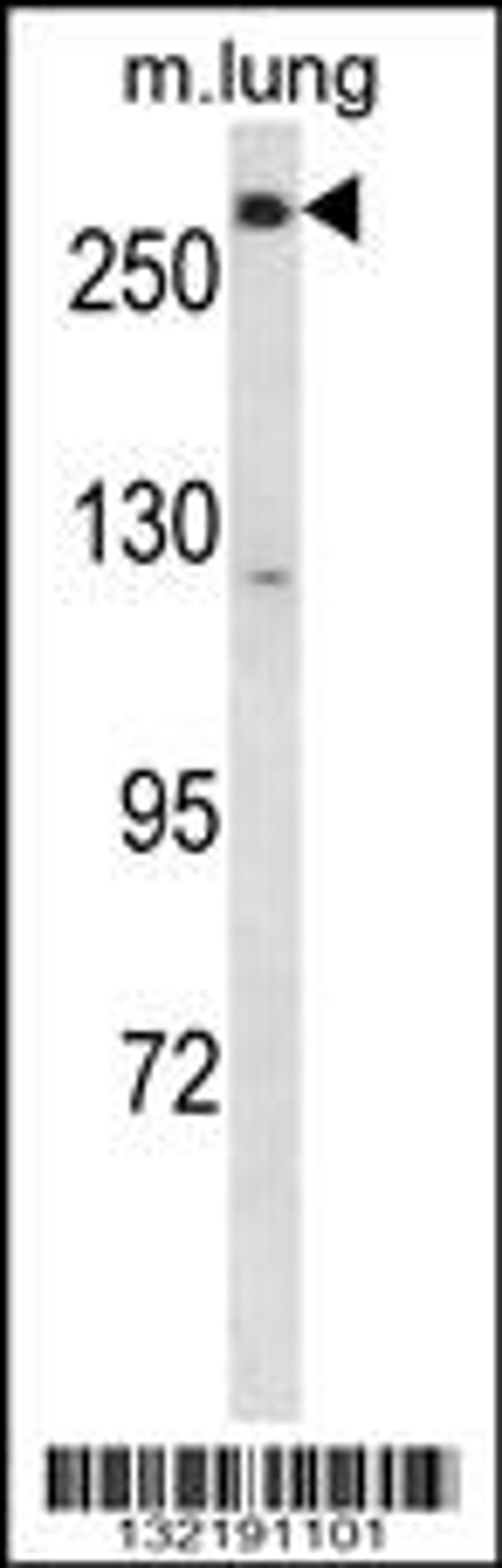 Western blot analysis in mouse lung tissue lysates (35ug/lane).