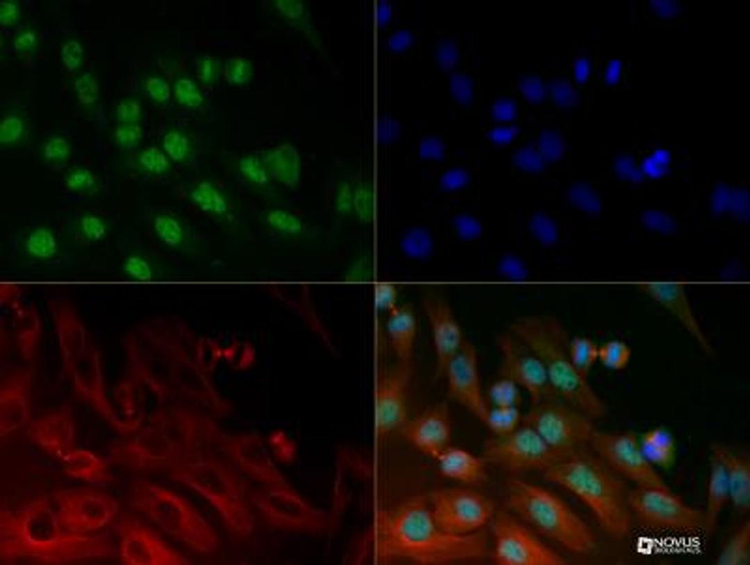 Immunocytochemistry/Immunofluorescence: BRD4 Antibody [NB100-56487] - BRD4 antibody was tested in Hela cells with DyLight 488 (green). Nuclei and alpha-tubulin were counterstained with DAPI (blue) and Dylight 550 (red).