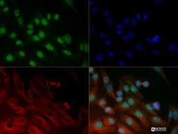 Immunocytochemistry/Immunofluorescence: BRD4 Antibody [NB100-56487] - BRD4 antibody was tested in Hela cells with DyLight 488 (green). Nuclei and alpha-tubulin were counterstained with DAPI (blue) and Dylight 550 (red).