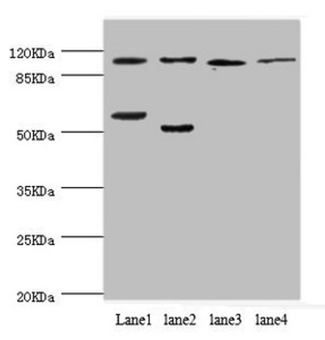 Western blot. All lanes: PITRM1 antibody at 2.42ug/ml. Lane 1: Mouse placenta tissue. Lane 2: A549 whole cell lysate. Lane 3: Rat gonad tissue. Lane 4: Mouse kidney tissue. Secondary. Goat polyclonal to rabbit IgG at 1/10000 dilution. Predicted band size: 118, 107 kDa. Observed band size: 118, 50 kDa. 