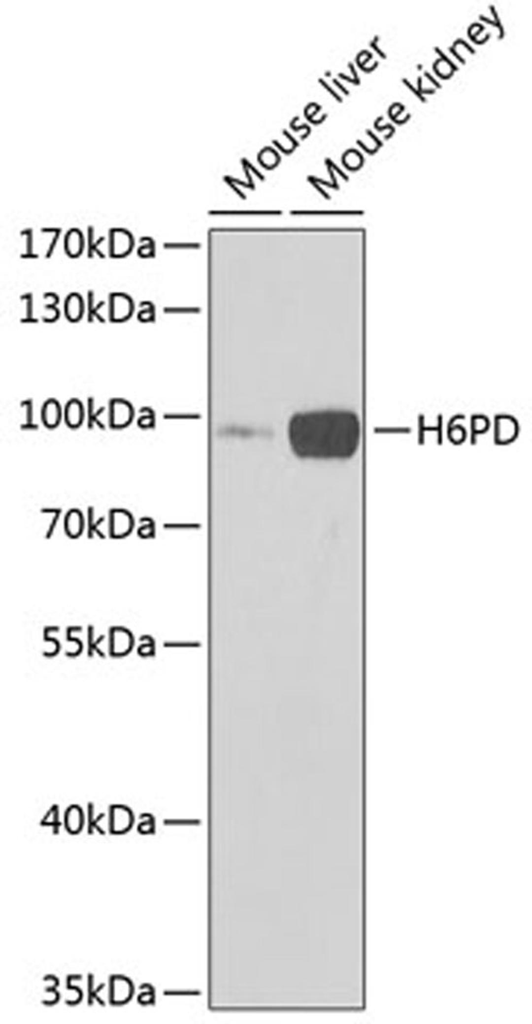 Western blot - H6PD Antibody (A6440)