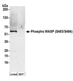 Detection of human Phospho WASP (S483/S484) by western blot.