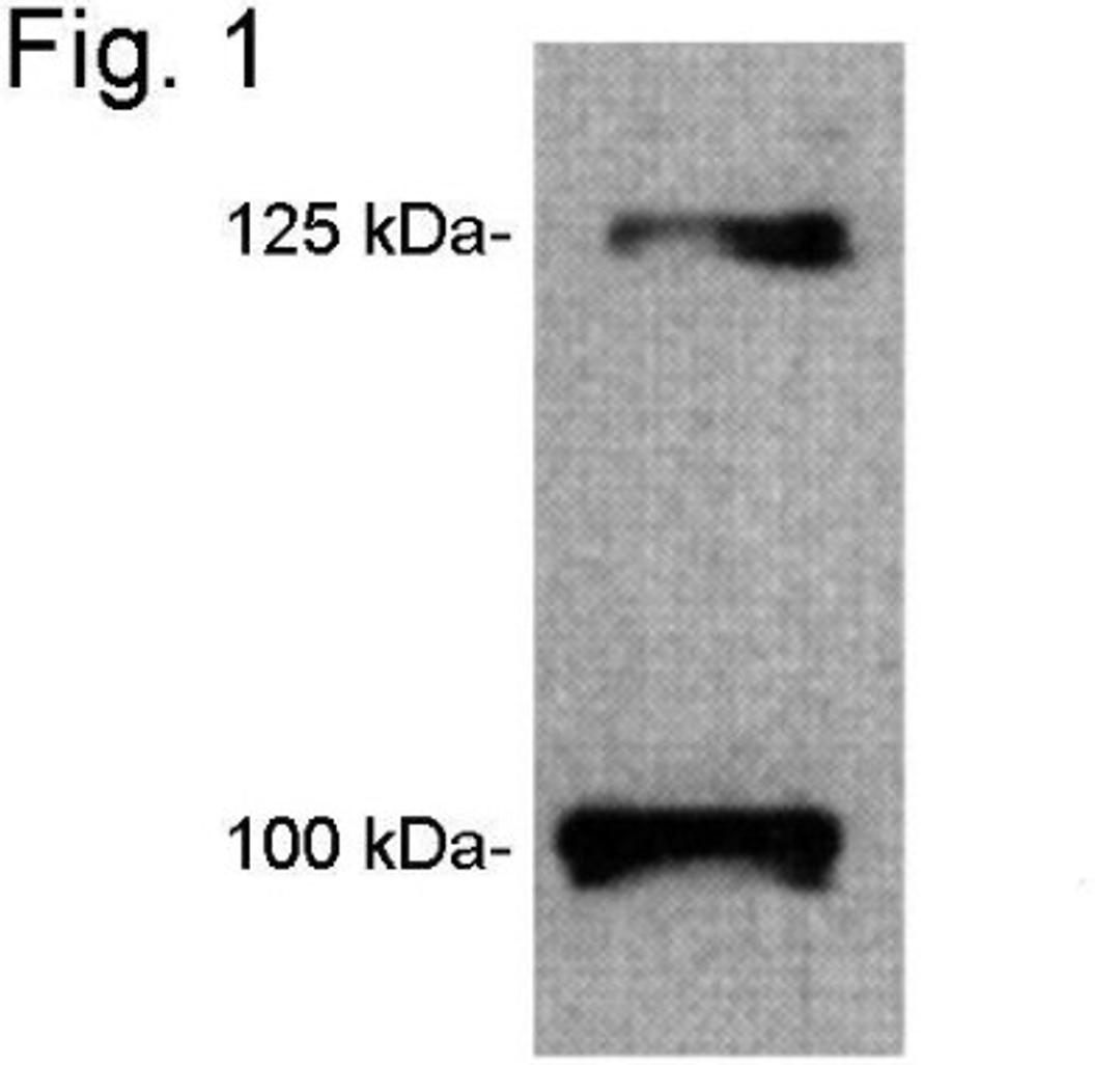 Western Blot: Leptin R Antibody [NB120-5593] - Analysis of both short and long forms of OB-R from mouse lung tissue extract.