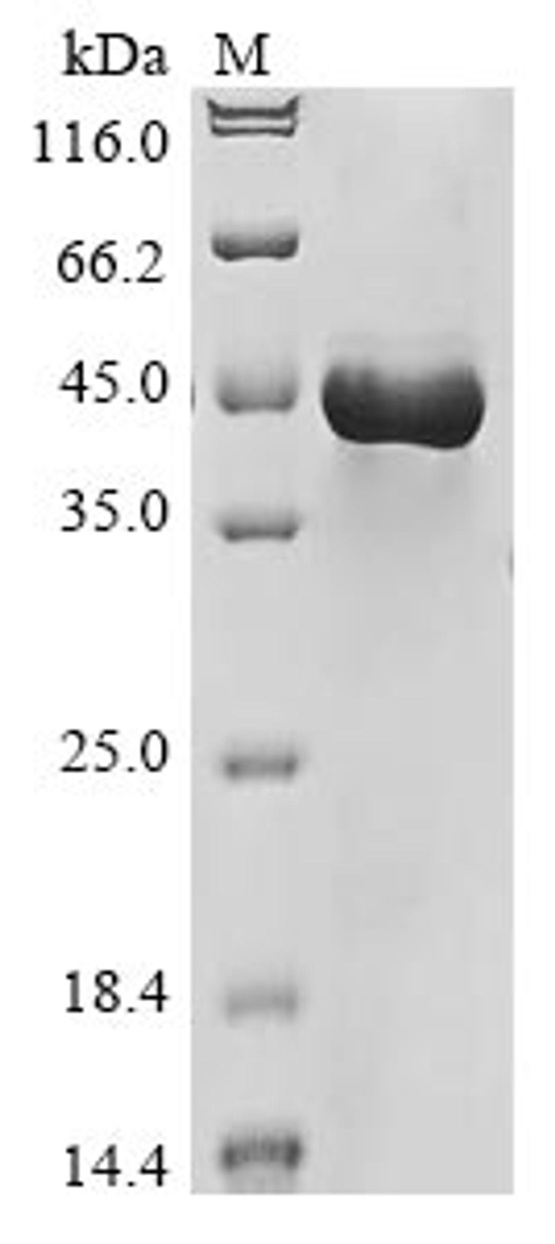 (Tris-Glycine gel) Discontinuous SDS-PAGE (reduced) with 5% enrichment gel and 15% separation gel.