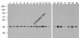 Western blot analysis of GAPDH in 293, A431, A549, Daudi, HeLa, HepG2, Jurkat, K562, MOLT4, 3T3, Raji, Ramos, U937, human brain, mouse brain, rat brain, mouse lung, mouse liver, rat liver, and chicken small intestine lysate with Biotin-GAPDH antibody at 1