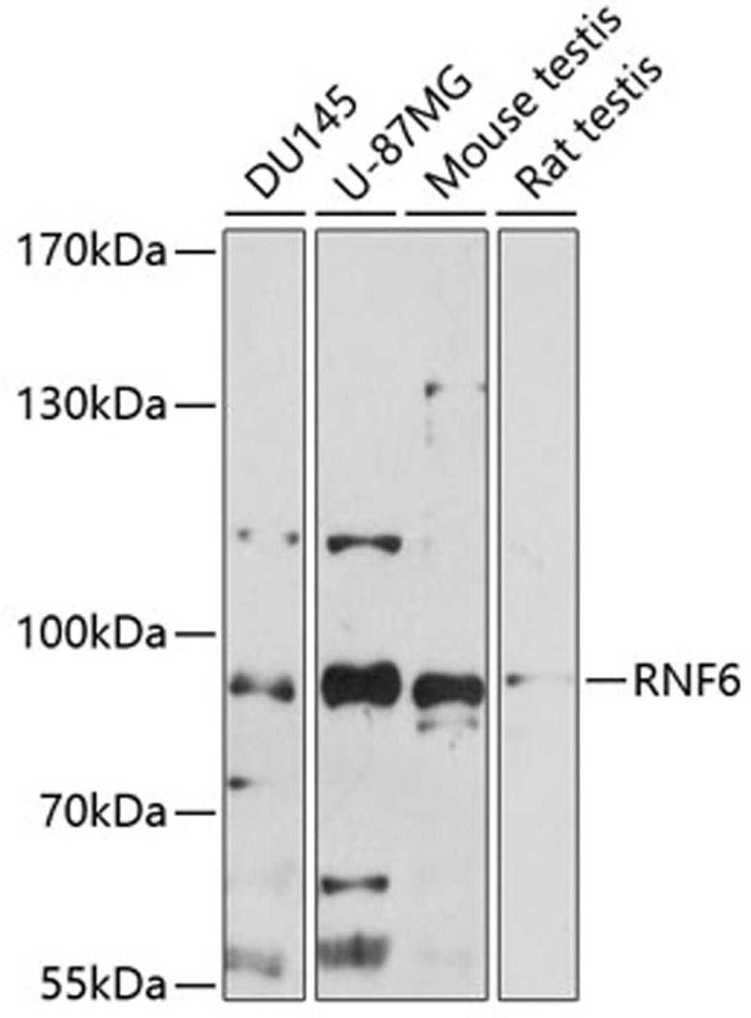 Western blot - RNF6 antibody (A14572)