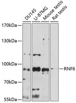 Western blot - RNF6 antibody (A14572)