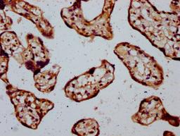 IHC image of CSB-PA025149LA01HU diluted at 1:400 and staining in paraffin-embedded human placenta tissue performed on a Leica BondTM system. After dewaxing and hydration, antigen retrieval was mediated by high pressure in a citrate buffer (pH 6.0). Section was blocked with 10% normal goat serum 30min at RT. Then primary antibody (1% BSA) was incubated at 4°C overnight. The primary is detected by a biotinylated secondary antibody and visualized using an HRP conjugated SP system.