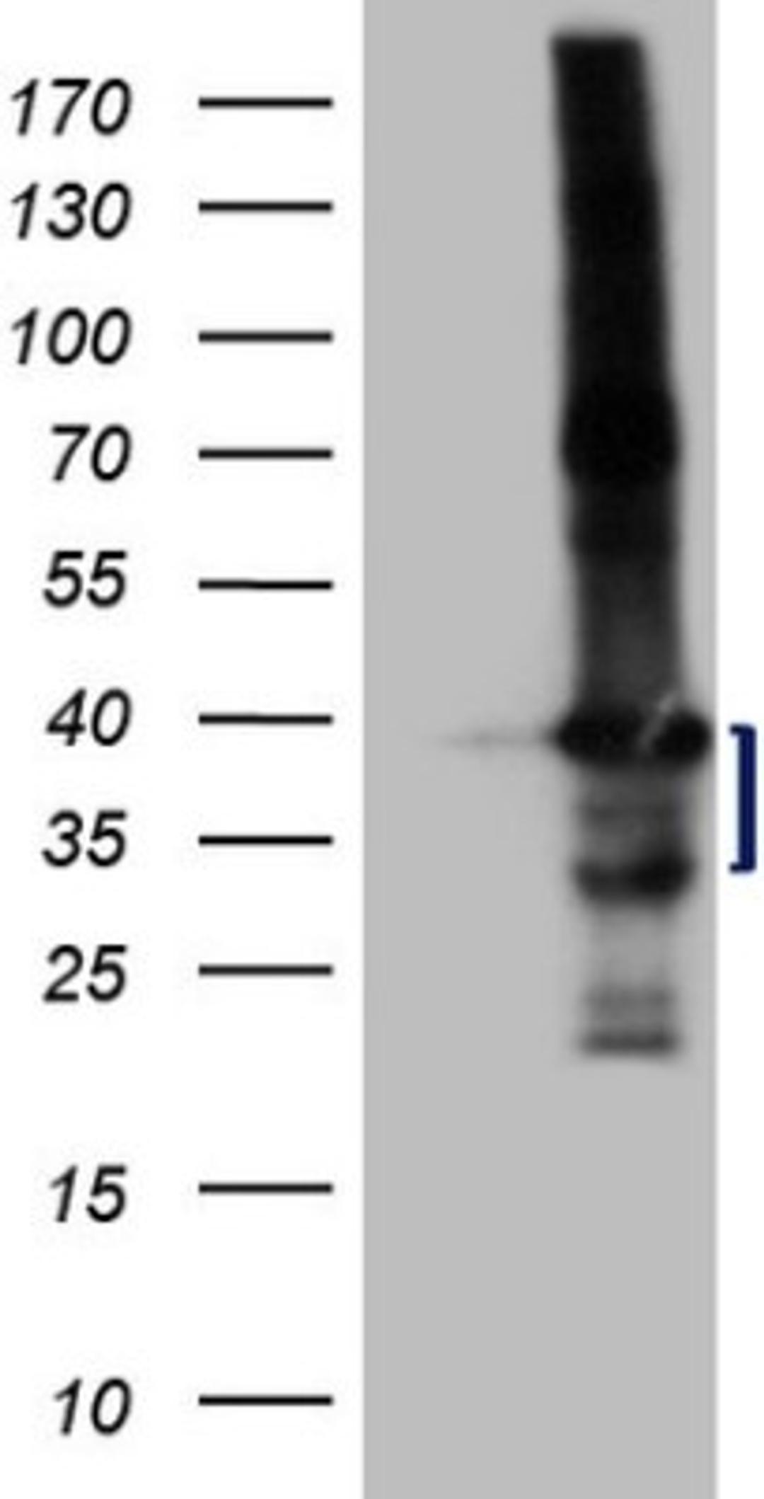 Western Blot: LIME Antibody (5D3) [NBP2-45653] - Analysis of HEK293T cells were transfected with the pCMV6-ENTRY control (Left lane) or pCMV6-ENTRY LIME1.