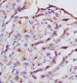 IHC-P of rat lung tissue (IQGAP1 antibody at 1:200)