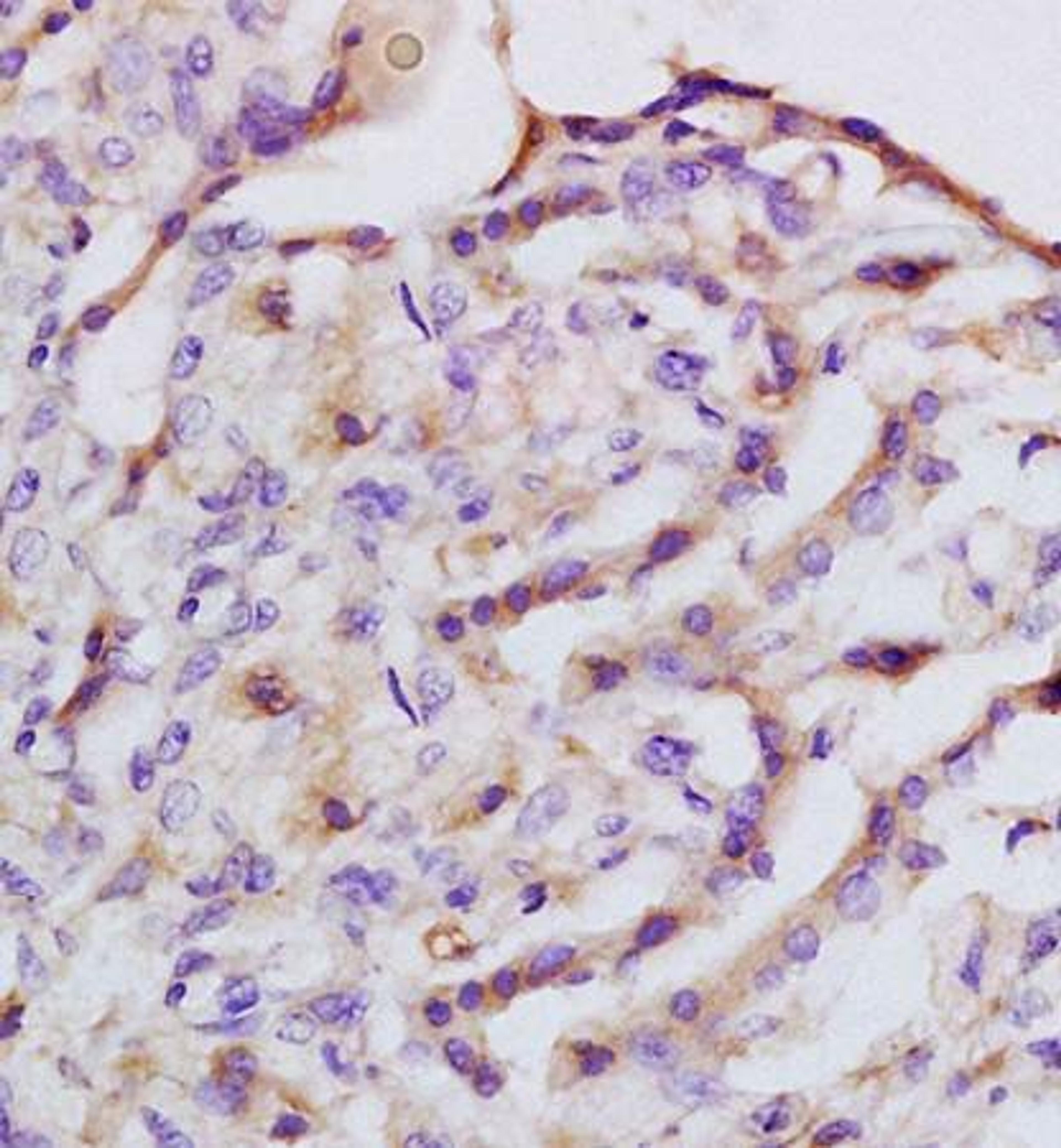 IHC-P of rat lung tissue (IQGAP1 antibody at 1:200)