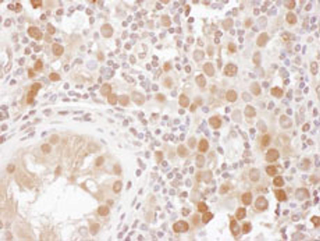 Detection of human CSE1 by immunohistochemistry.