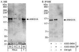 Detection of human ANKS1A by western blot and immunoprecipitation.