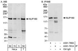 Detection of human NUP160 by western blot and immunoprecipitation.