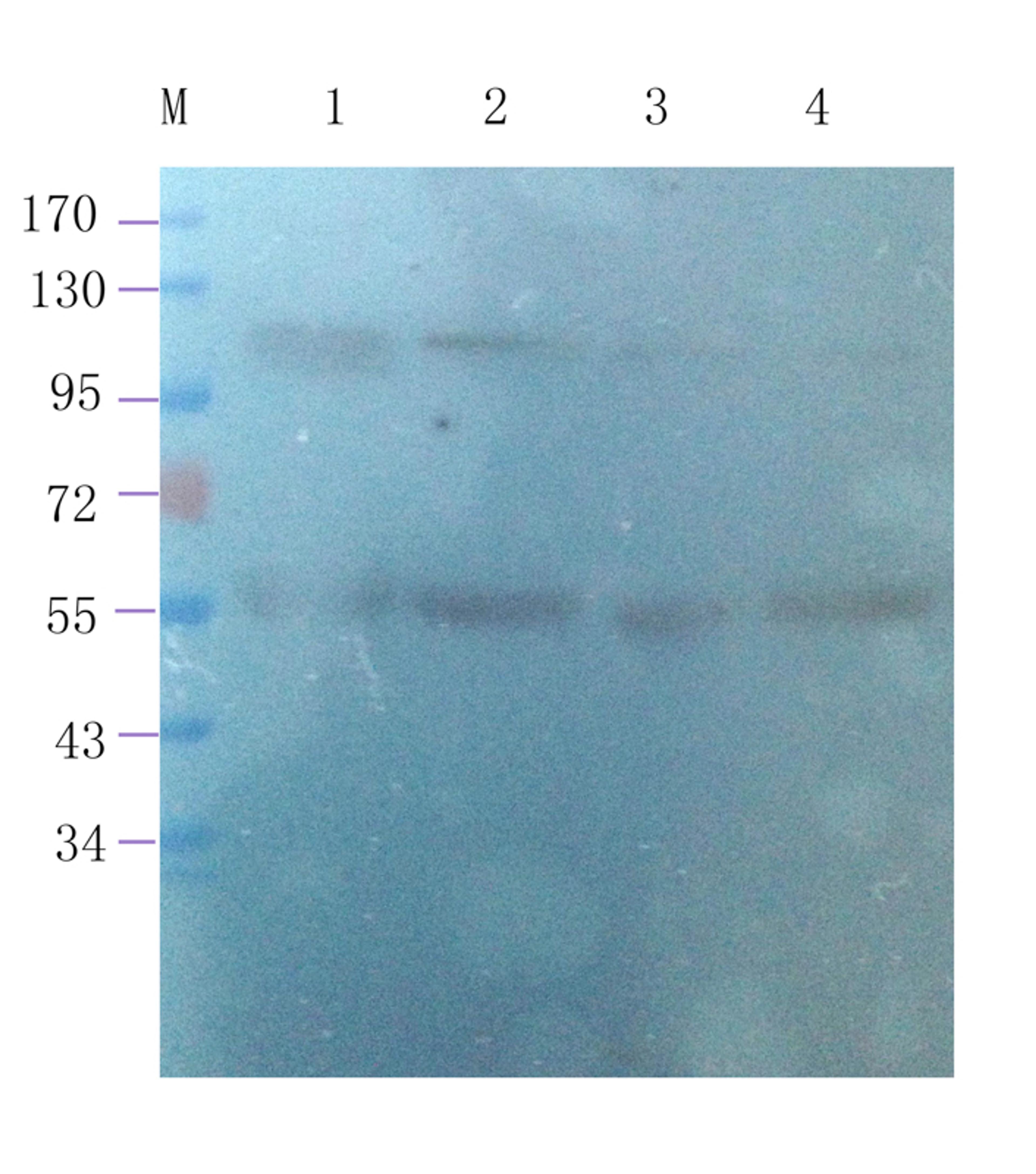 WB analysis of human breast cancer 24 (lane 1), human mammary fibroma 4 (lane 2), human mammary fibroma 5 (lane 3), human breast cancer 25 (lane 4) using Leptin Receptor (1 ug/ml)