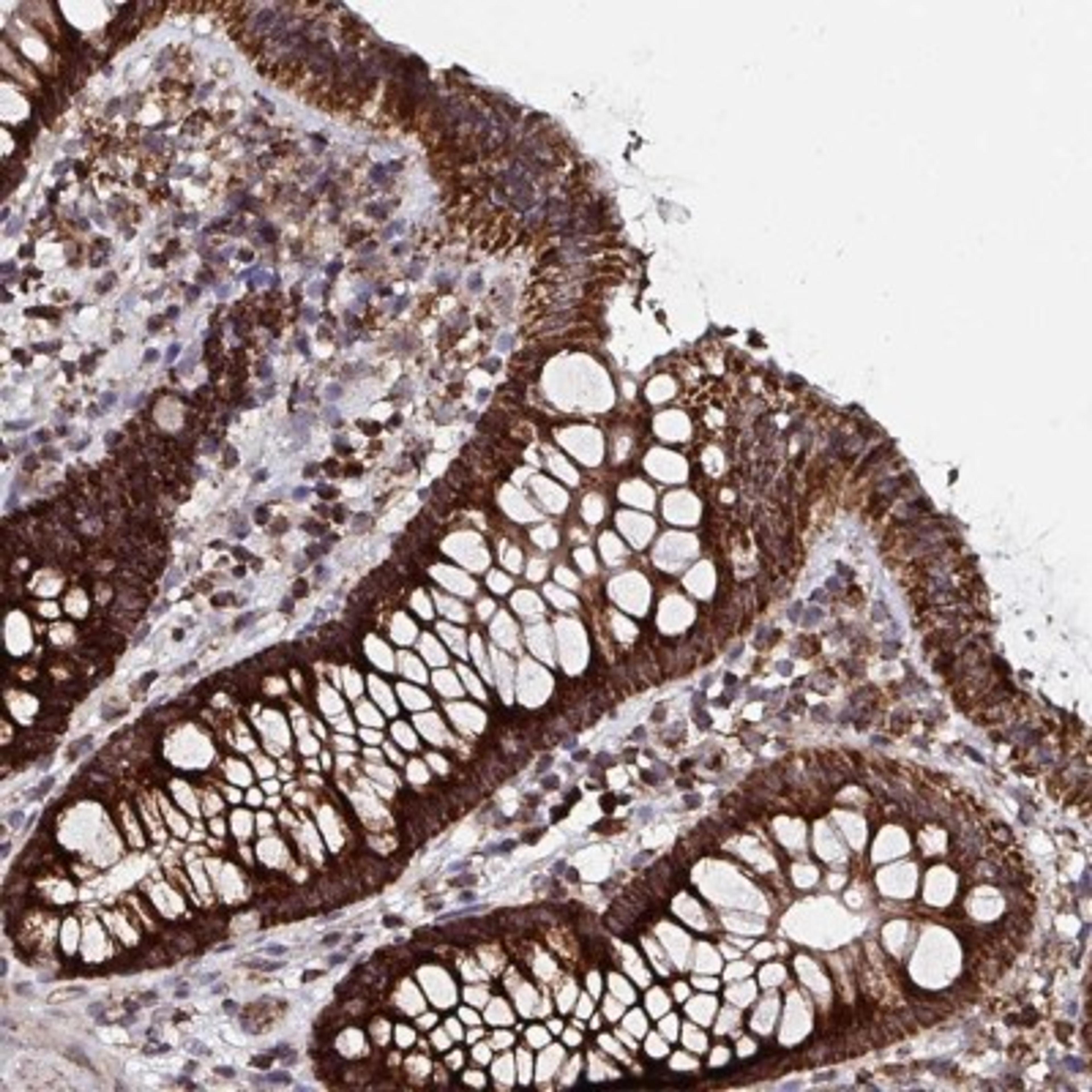 Immunohistochemistry: ATAD3B Antibody [NBP2-32409] - Staining of human colon shows strong granular cytoplasmic positivity in glandular cells.