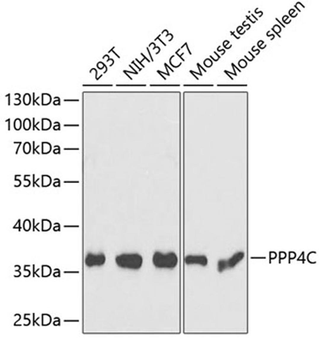 Western blot - PPP4C antibody (A13531)