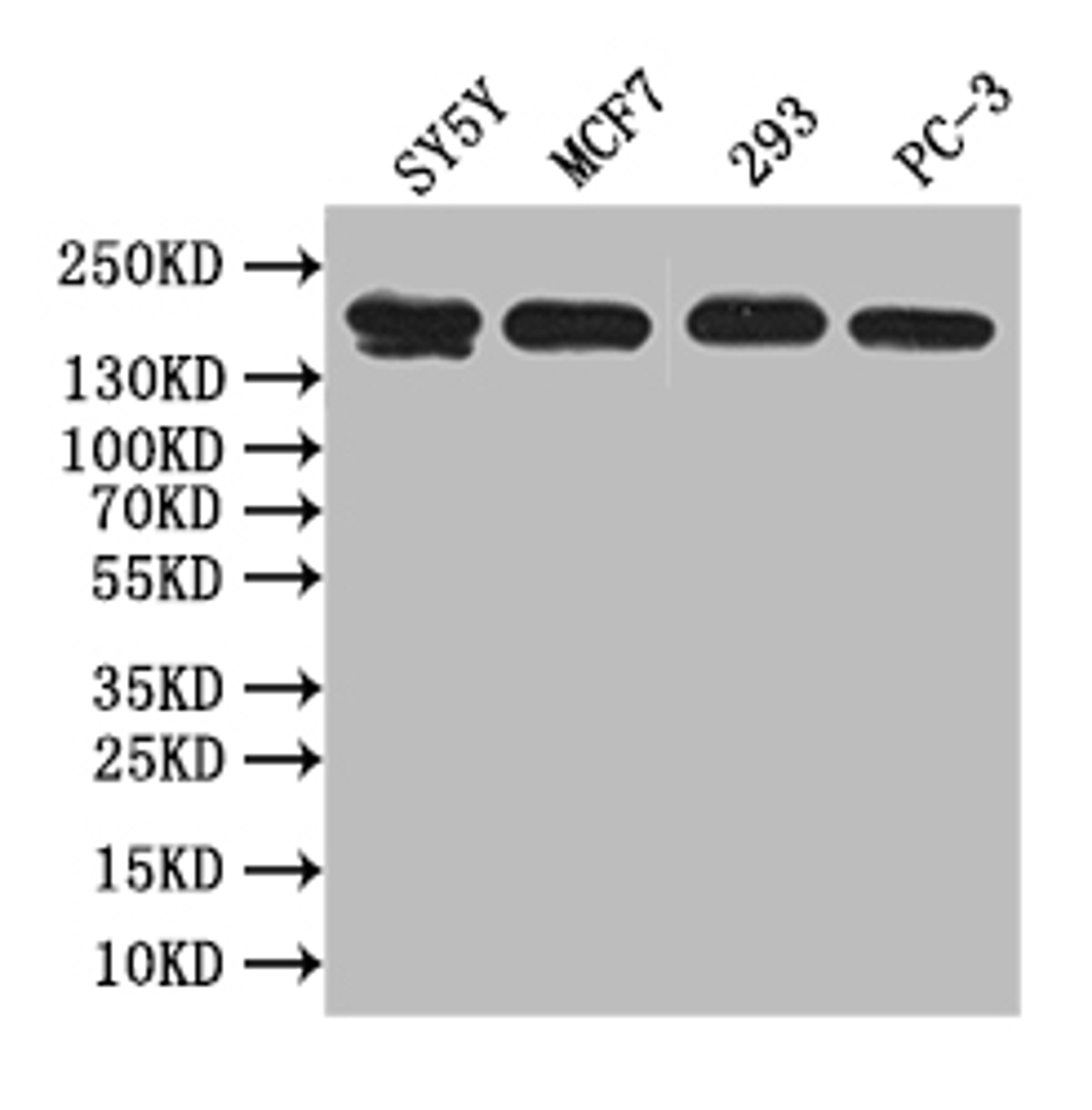 Western Blot. Positive WB detected in: SY5Y whole cell lysate, MCF7 whole cell lysate, 293 whole cell lysate, PC-3 whole cell lysate. All lanes: ABCA3 antibody at 1:1000. Secondary. Goat polyclonal to rabbit IgG at 1/50000 dilution. Predicted band size: 192 kDa. Observed band size: 192 kDa. 