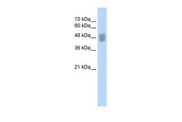 Antibody used in WB on Human HepG2 at 0.2-1 ug/ml.