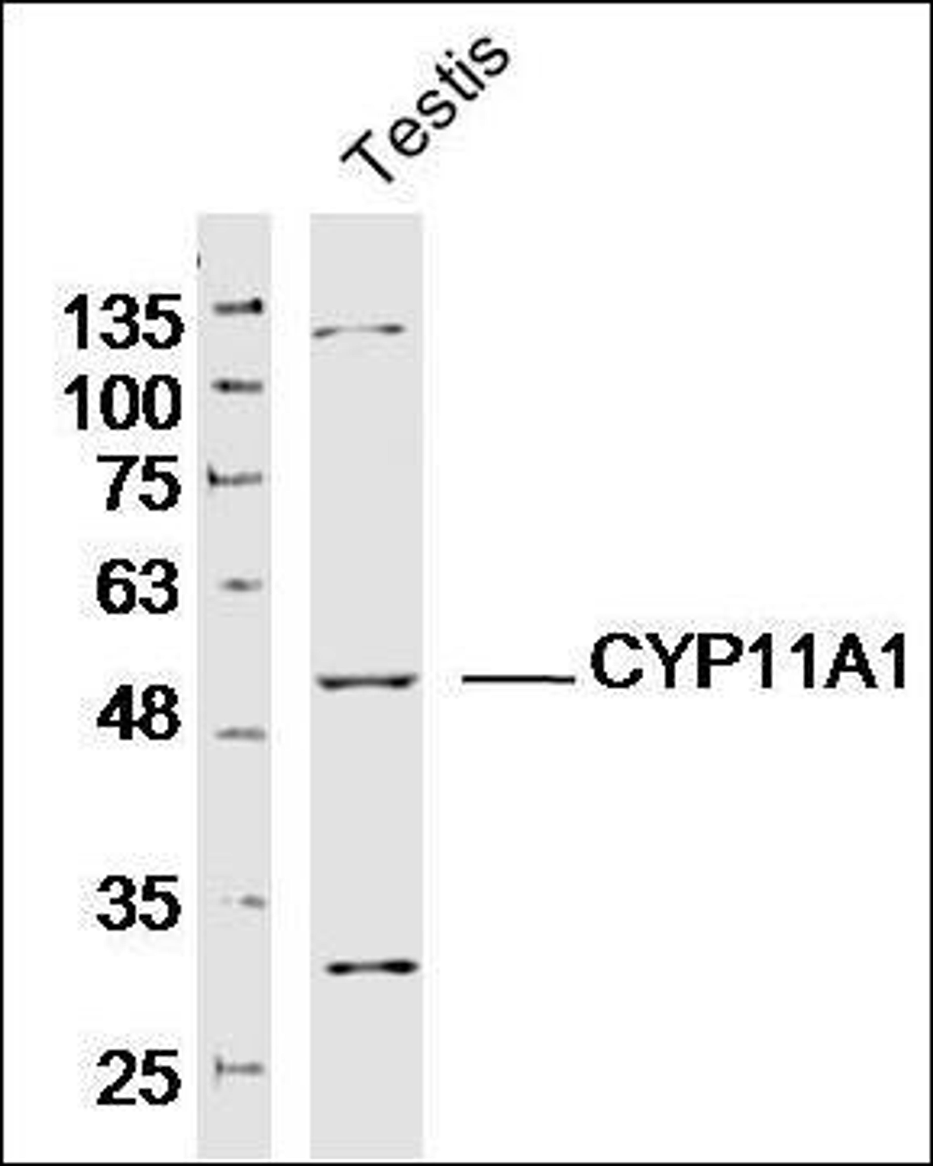 Western blot analysis of Mouse Testis Lysate using CYP11A1 antibody.