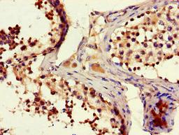 Immunohistochemistry of paraffin-embedded human testis tissue using CSB-PA735976LA01HU at dilution of 1:100