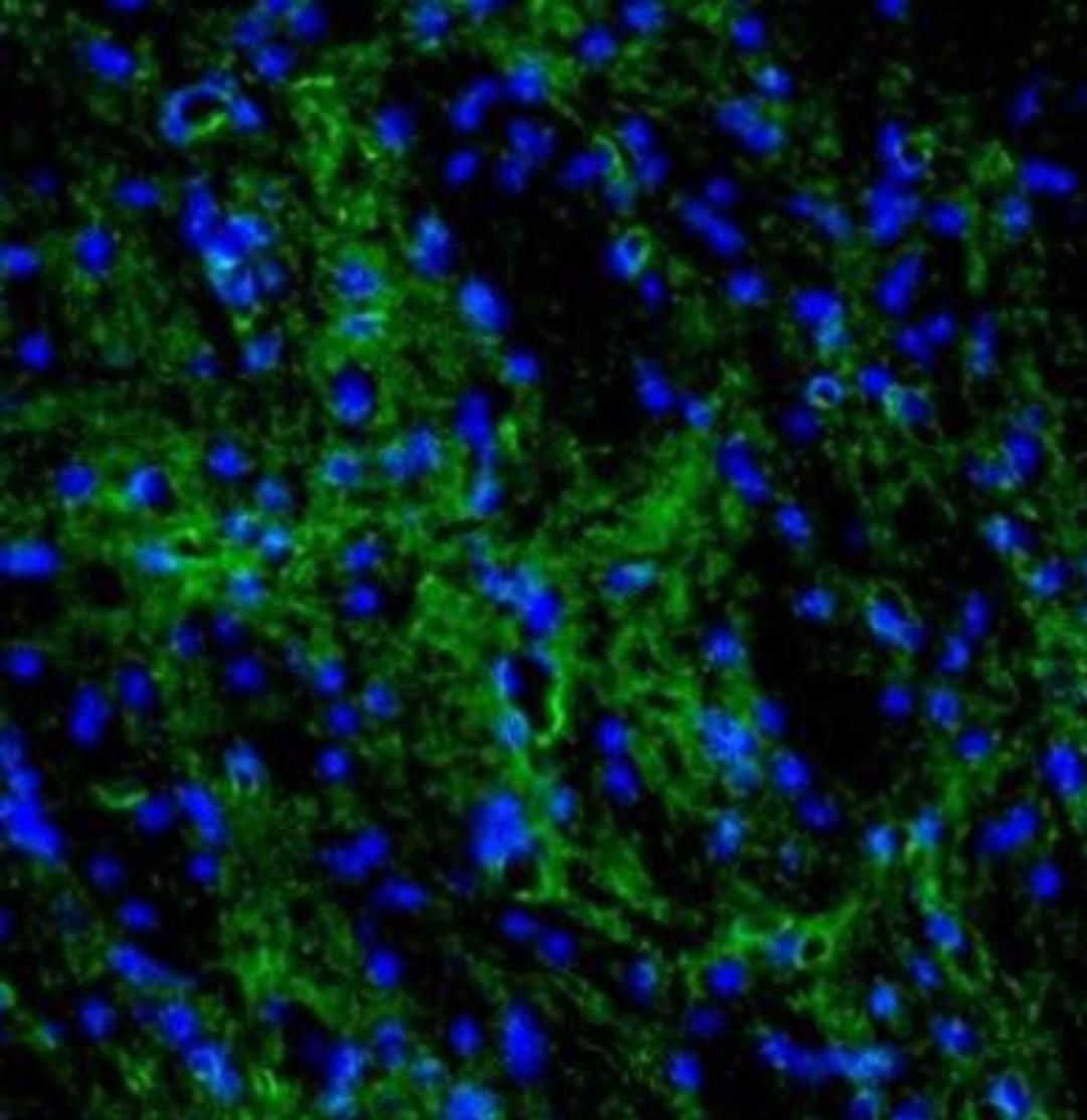 Immunocytochemistry/Immunofluorescence: Aquaporin-4 Antibody [NBP1-87679] - Staining of mouse caudate putamen shows strong immunoreactivity in astrocytes.