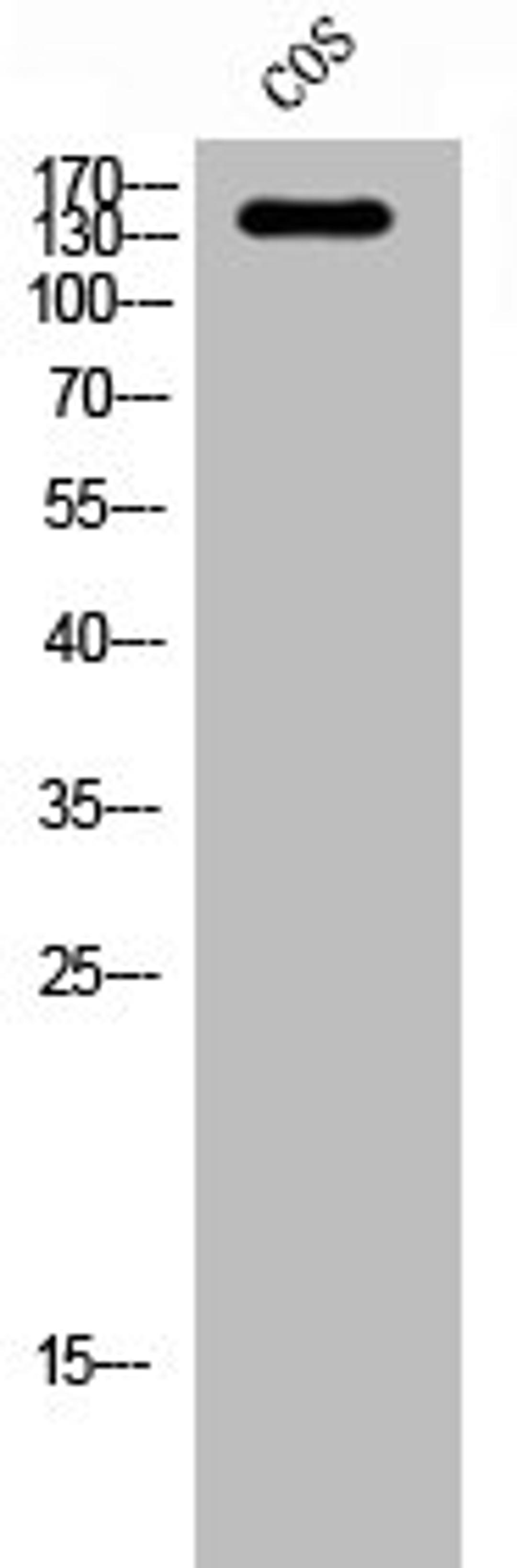 Western Blot analysis of COS cells using Abl1 Polyclonal Antibody