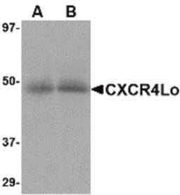 Western blot analysis of CXCR4 in (A) human spleen and (B) human thymus tissue lysate with CXCR4-Lo antibody at 10 μg/mL.