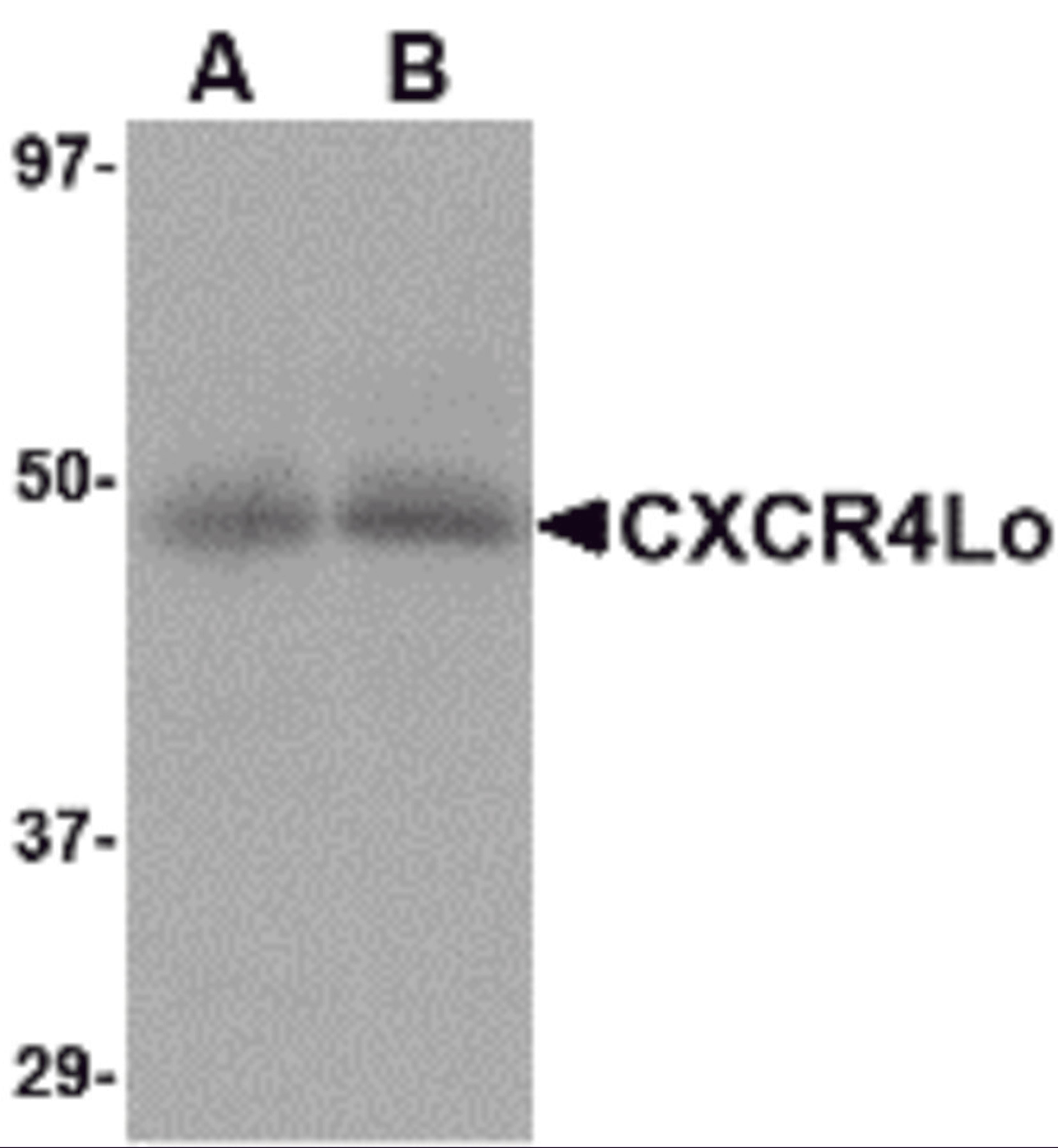Western blot analysis of CXCR4 in (A) human spleen and (B) human thymus tissue lysate with CXCR4-Lo antibody at 10 μg/mL.