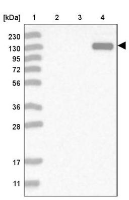 Western Blot: MYOM3 Antibody [NBP1-81960] - Lane 1: Marker [kDa] 230, 130, 95, 72, 56, 36, 28, 17, 11<br/>Lane 2: Human cell line RT-4<br/>Lane 3: Human cell line U-251MG sp<br/>Lane 4: Human plasma (IgG/HSA depleted)