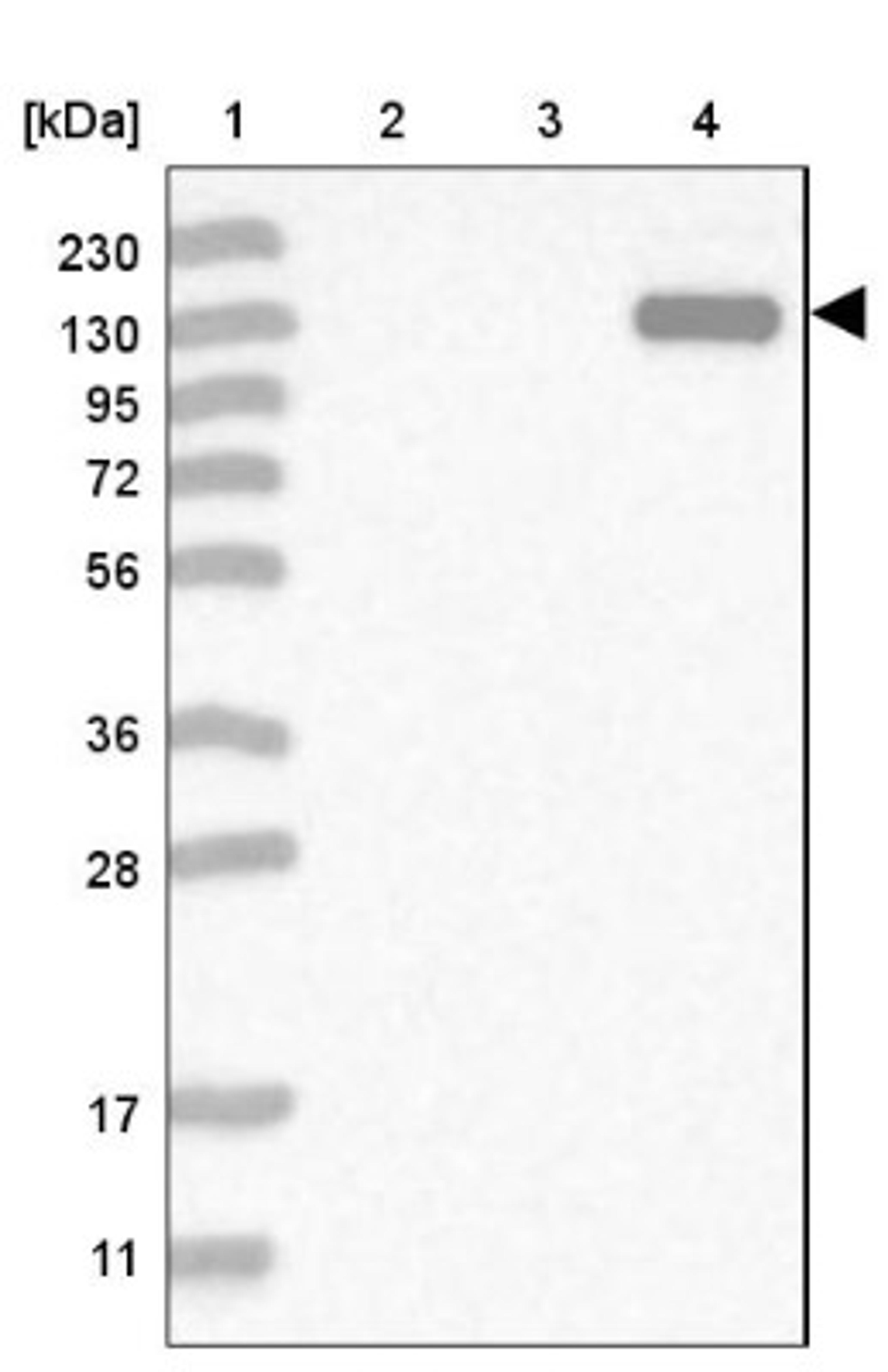 Western Blot: MYOM3 Antibody [NBP1-81960] - Lane 1: Marker [kDa] 230, 130, 95, 72, 56, 36, 28, 17, 11<br/>Lane 2: Human cell line RT-4<br/>Lane 3: Human cell line U-251MG sp<br/>Lane 4: Human plasma (IgG/HSA depleted)