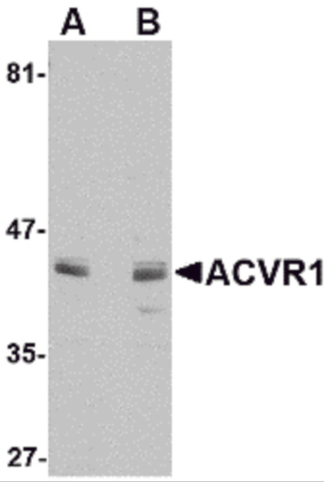 Western blot analysis of ACVR1 in A549 cell lysate with ACVR1 antibody at (A) 1 and (B) 2 &#956;g/mL.