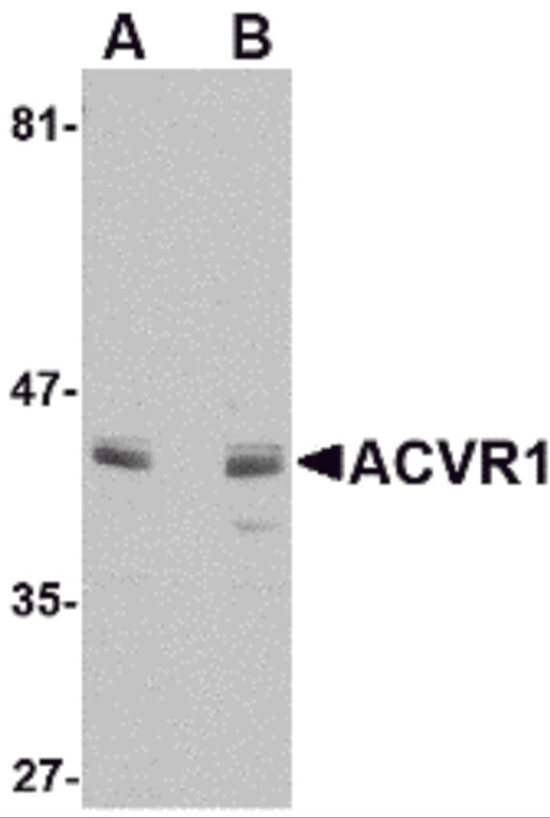 Western blot analysis of ACVR1 in A549 cell lysate with ACVR1 antibody at (A) 1 and (B) 2 μg/mL.