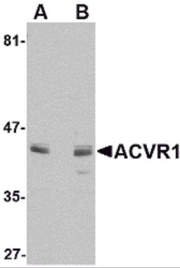 Western blot analysis of ACVR1 in A549 cell lysate with ACVR1 antibody at (A) 1 and (B) 2 μg/mL.