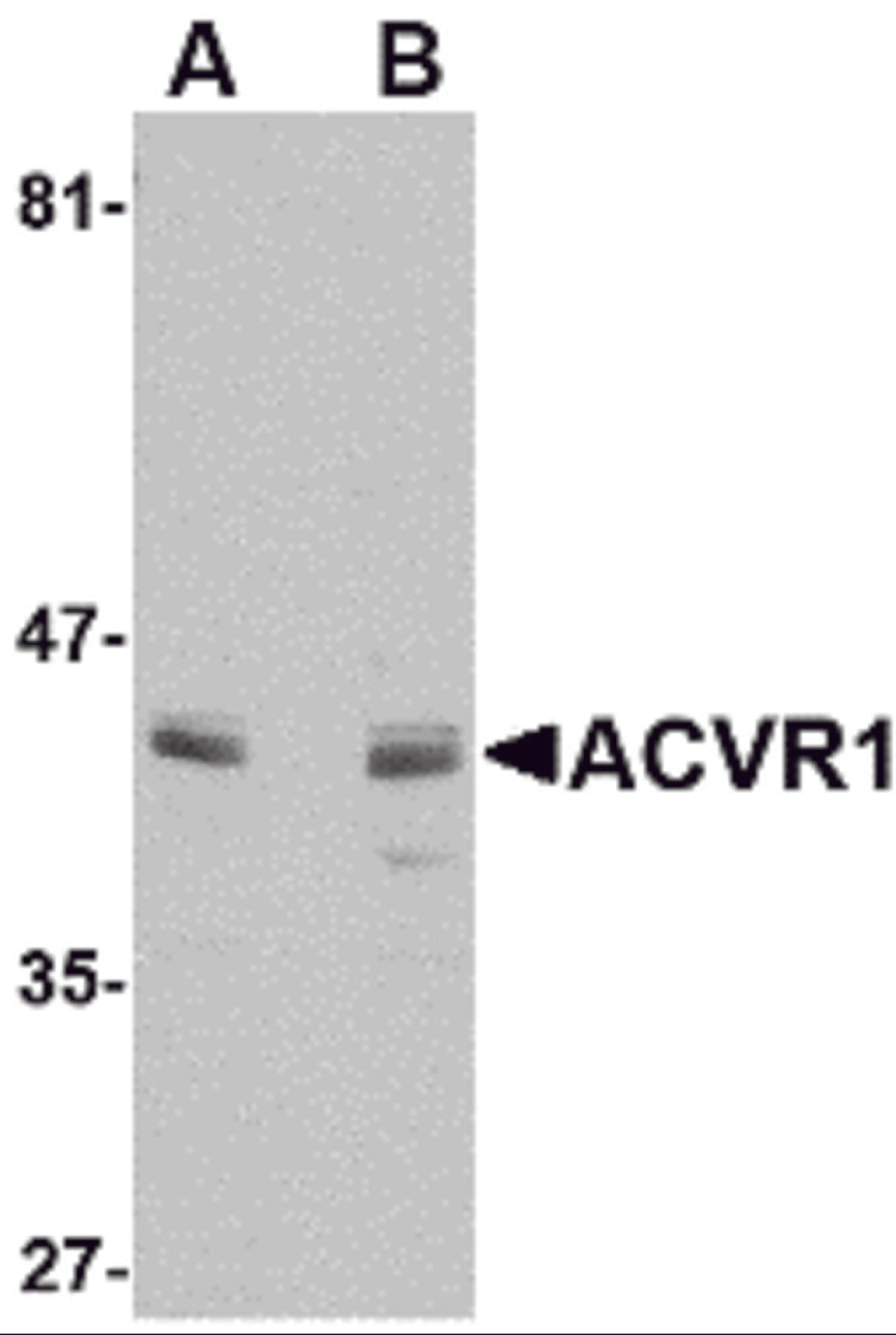 Western blot analysis of ACVR1 in A549 cell lysate with ACVR1 antibody at (A) 1 and (B) 2 μg/mL.