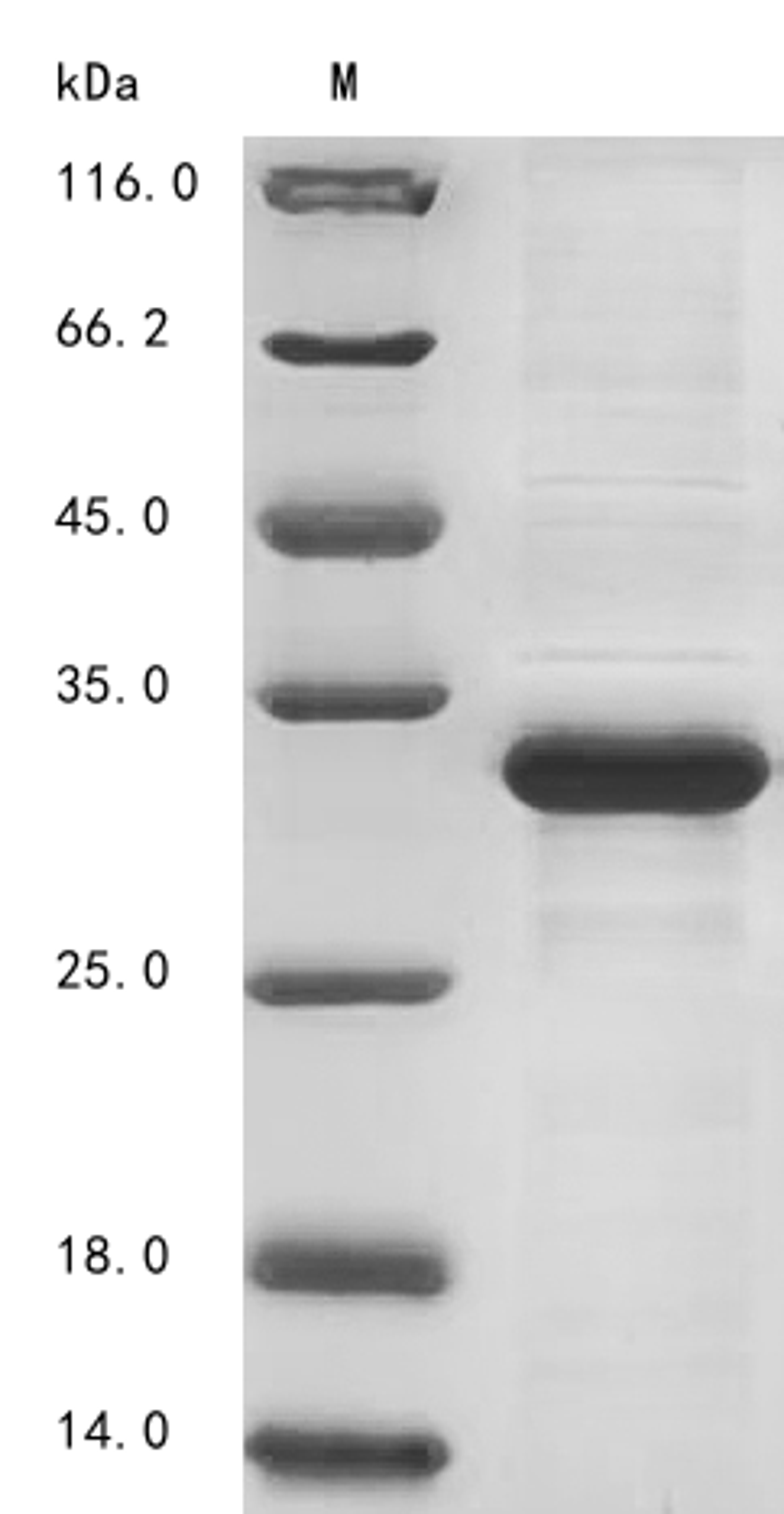 (Tris-Glycine gel) Discontinuous SDS-PAGE (reduced) with 5% enrichment gel and 15% separation gel.