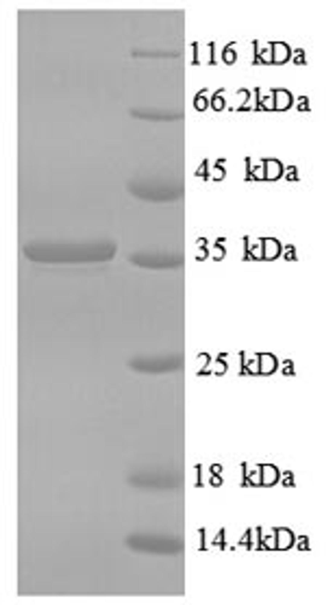 (Tris-Glycine gel) Discontinuous SDS-PAGE (reduced) with 5% enrichment gel and 15% separation gel.