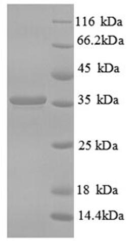 (Tris-Glycine gel) Discontinuous SDS-PAGE (reduced) with 5% enrichment gel and 15% separation gel.