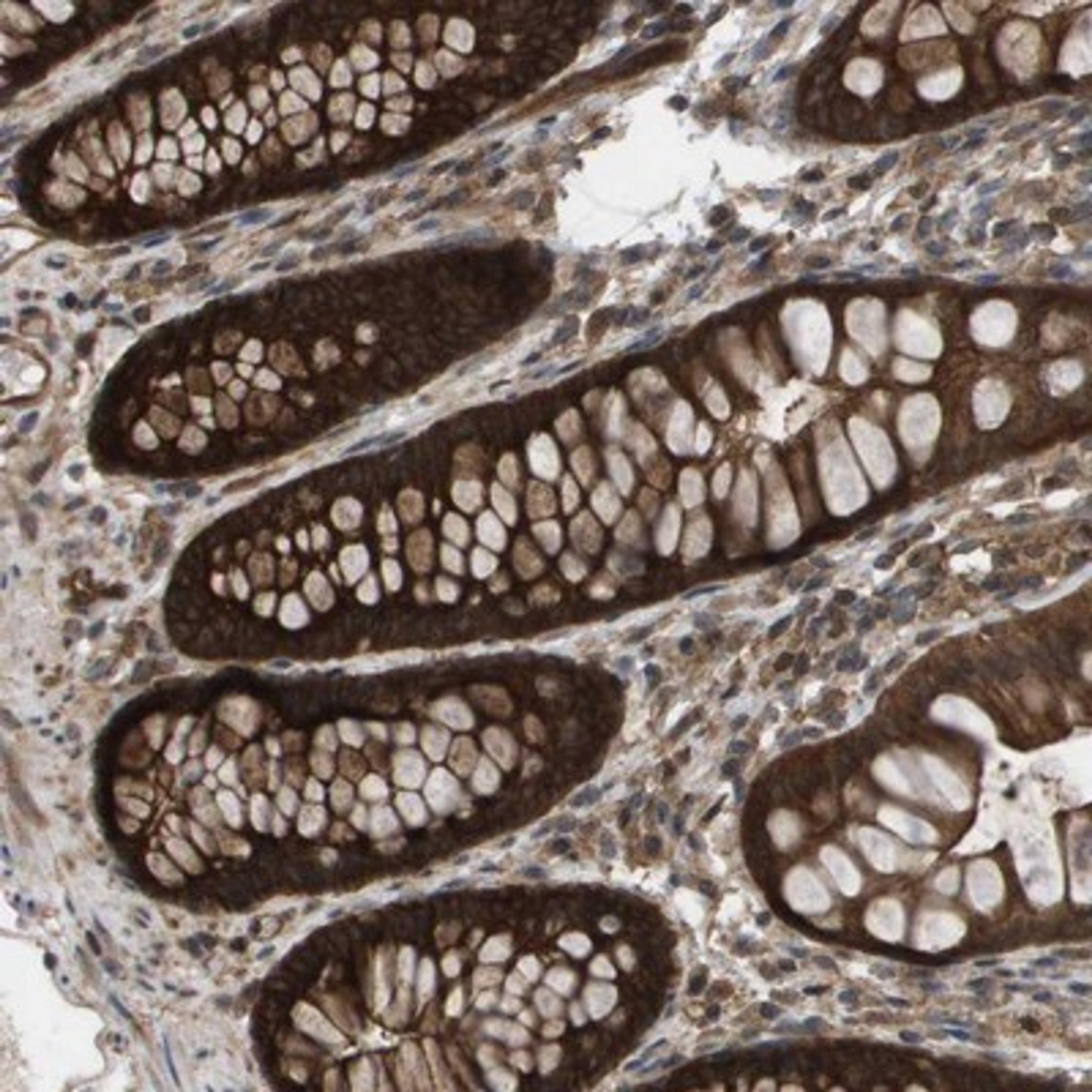 Immunohistochemistry-Paraffin: CTPS2 Antibody [NBP1-86055] - Staining of human colon shows strong cytoplasmic and nuclear positivity in glandular cells.